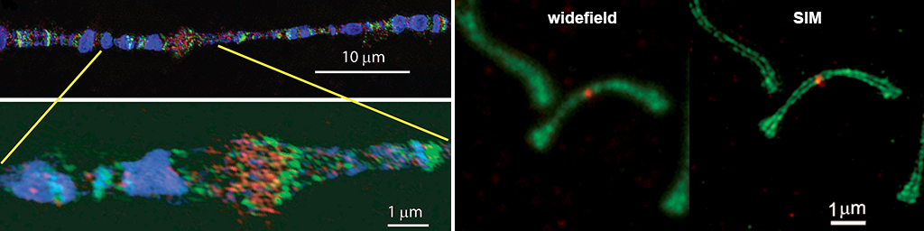 Single molecule imaging and quantification