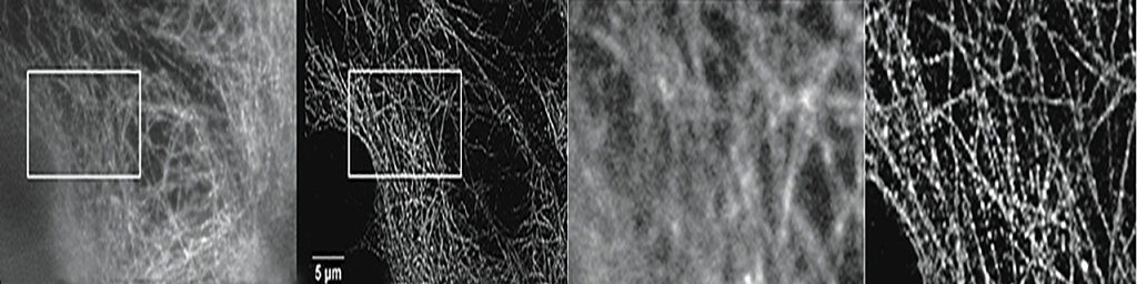 Single molecule imaging and quantification
